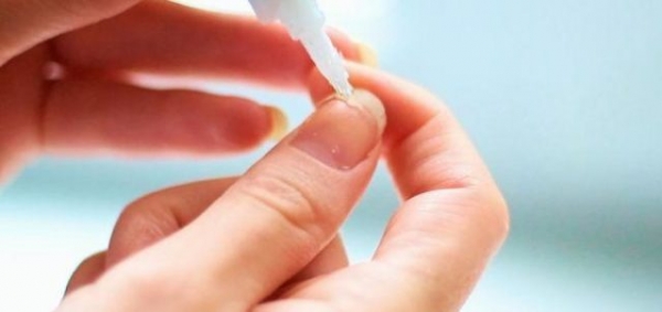 Что делать, если у вас сломался ноготь? Что делать, если у вас сломался ноготь?