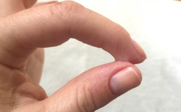 Как безболезненно снять супер клей с ногтей? Как безболезненно снять супер клей с ногтей?