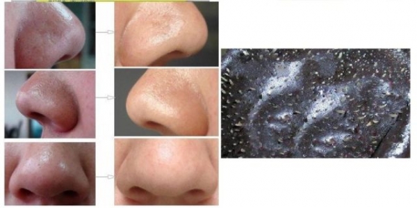 Как сделать маску из клея ПВА и активированного угля Как сделать маску из клея ПВА и активированного угля