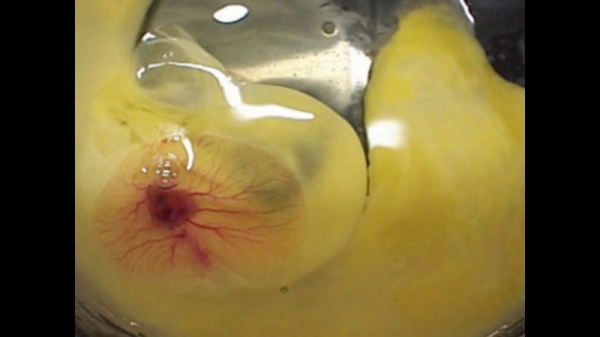 Яйца с двумя желтками — ждем близнецов? Яйца с двумя желтками — ждем близнецов?